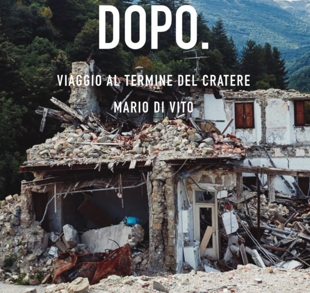 dopo