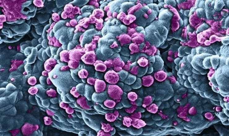 cancro cellule: come scoprirlo da sintomi