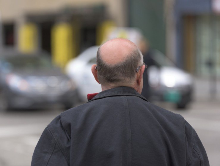 Quanti capelli cadono ogni giorno?