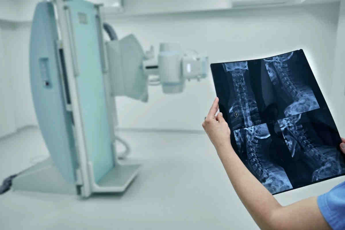 Corso di laurea in tecniche di radiologia medica per immagini ascoli piceno