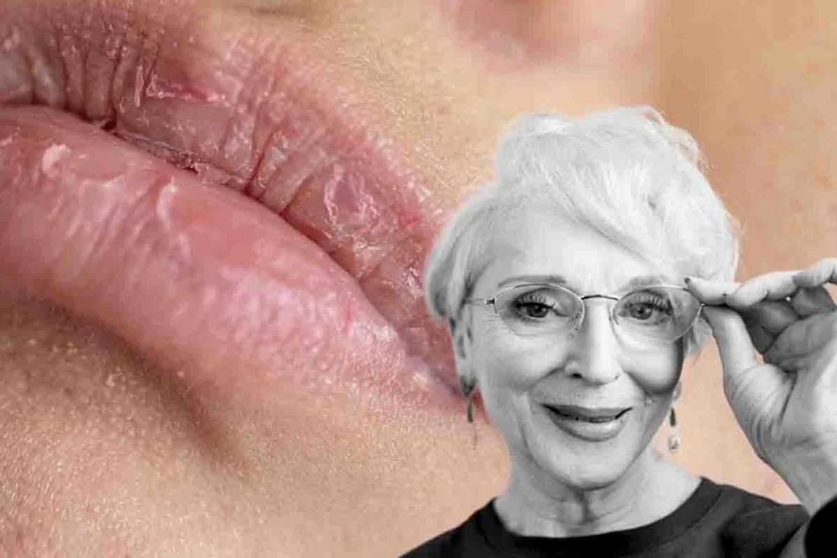 rimedi della nonna per labbra screpolate