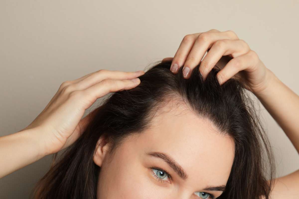 9 metodi che funzionano per far ricrescere i capelli