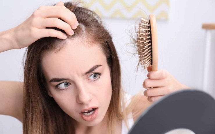 Caduta dei capelli, un problema anche femminile