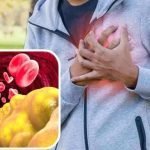 Come prevenire un attacco di cuore