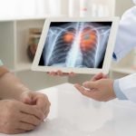 Cancro ai polmoni: il sintomo che può salvarti