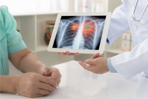Cancro ai polmoni: il sintomo che può salvarti