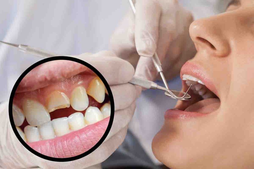 Denti danni irreversibili avvertimento