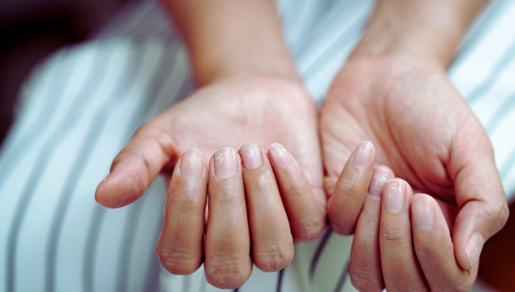 Capelli sottili e unghie fragili Non sono da sottovalutare