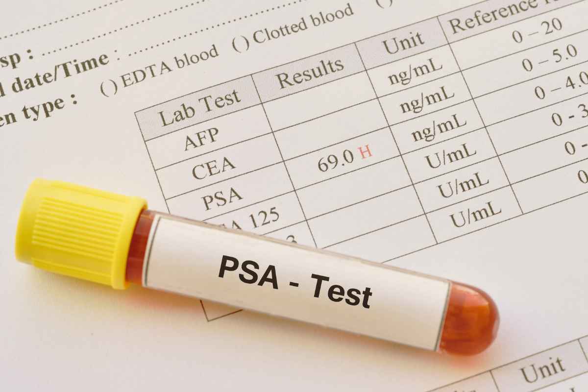 Psa trasmissione contagio uomo