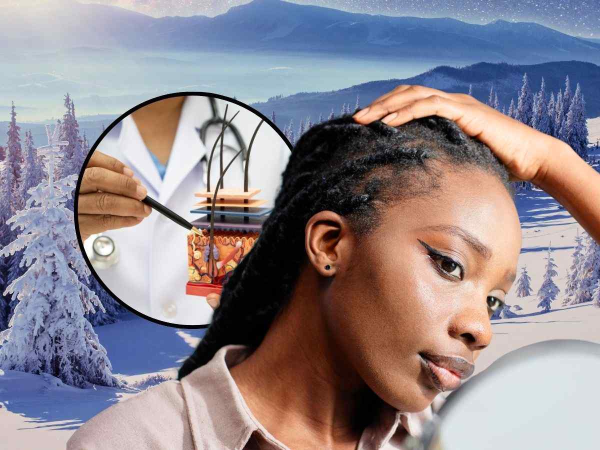 sfondo inverno, tondo con dermatologo e ragazza che controlla cute capelli